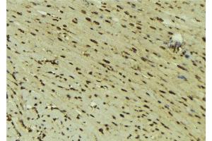 ABIN6277618 at 1/100 staining Mouse muscle tissue by IHC-P. (DNMT1 Antikörper  (Internal Region))