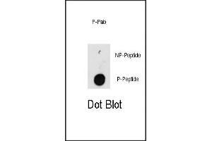 Dot blot analysis of anti-ILK-p Pab (R) on nitrocellulose membrane. (ILK Antikörper  (pThr173))