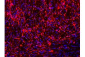 Immunofluorescence staining of paraffin-embedded Glioma cells of Spinal Cord using MAP2 Antibody. (MAP2 Antikörper)