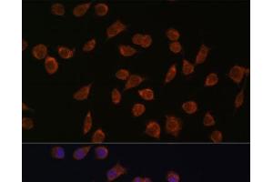 Immunofluorescence analysis of L929 cells using ACSS1 Polyclonal Antibody at dilution of 1:100. (ACSS1 Antikörper)