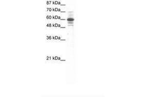 Image no. 1 for anti-Zinc Finger Protein 276 (ZNF276) (AA 284-333) antibody (ABIN6736062) (ZNF276 Antikörper  (AA 284-333))