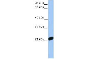 Factor X antibody used at 1 ug/ml to detect target protein. (Coagulation Factor X Antikörper  (C-Term))