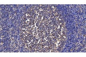 Immunohistochemistry (IHC) image for anti-Procollagen C-Endopeptidase Enhancer 2 (PCOLCE2) (AA 297-415) antibody (ABIN7438220)