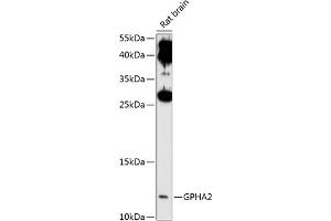 Western blot analysis of extracts of rat brain, using GPH antibody (ABIN6132023, ABIN6141322, ABIN6141323 and ABIN6214909) at 1:1000 dilution. (GPHa2 Antikörper  (AA 24-129))