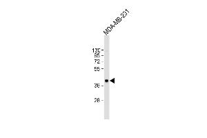 Anti-CYR61 Antibody (Center) at 1:2000 dilution + MDA-MB-231 whole cell lysate Lysates/proteins at 20 μg per lane.