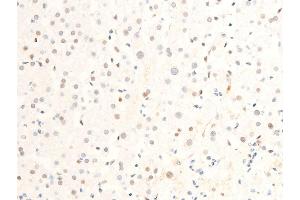 Immunohistochemistry (IHC) image for anti-Myc Proto-Oncogene protein (MYC) (pSer62) antibody (ABIN6255431)