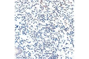 Immunohistochemistry of paraffin-embedded human appendix using P Rabbit mAb (ABIN7269152) at dilution of 1:100 (40x lens). (PAF1/PD2 Antikörper)
