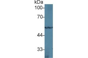 Western blot analysis of Rat Heart lysate, using Mouse PPARg Antibody (1 µg/ml) and HRP-conjugated Goat Anti-Rabbit antibody ( (PPARG Antikörper  (AA 149-273))