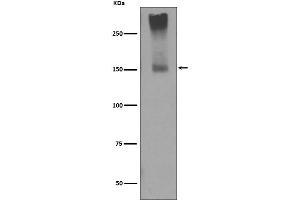 Western blot analysis of GRM5 expression in mouse brain lysate.
