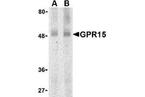 Western Blotting (WB) image for anti-G Protein-Coupled Receptor 15 (GPR15) (N-Term) antibody (ABIN1031395) (GPR15 Antikörper  (N-Term))