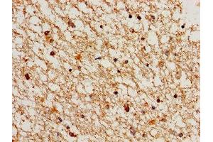 Immunohistochemistry of paraffin-embedded human brain tissue using ABIN7148834 at dilution of 1:100 (Cyclin A1 Antikörper  (AA 1-152))