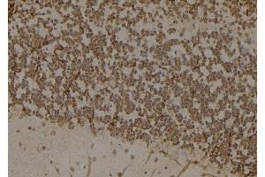 ABIN6276817 at 1/100 staining Mouse brain tissue by IHC-P.