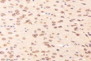 Immunohistochemistry analysis of paraffin-embedded mouse striatum using,RRAGB (ABIN7075379) at dilution of 1: 4000