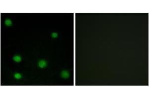 Immunofluorescence analysis of COS7 cells, using RBM6 Antibody. (RBM6 Antikörper  (AA 991-1040))