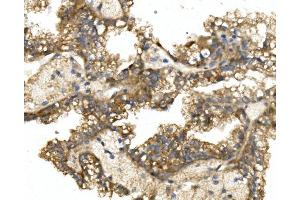 IHC analysis of GRB14 using anti-GRB14 antibody (ABIN7599149).