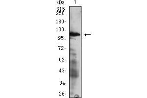 Western Blotting (WB) image for anti-Integrin alpha 4 (ITGA4) (AA 833-977) antibody (ABIN7193242)