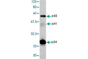 HIV-1 p24 抗体
