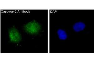 Immunofluorescent analysis of Hela cells, using Caspase-2 Antibody. (Rekombinanter Caspase 2 Antikörper)
