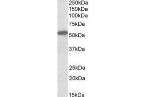 Western Blotting (WB) image for anti-Cannabinoid Receptor 1 (CNR1) (N-Term) antibody (ABIN2464497) (CNR1 Antikörper  (N-Term))