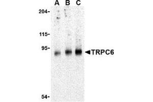 Western blot analysis of TRPC6 in mouse lung tissue lysate with this product at (A) 0.