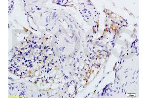 Formalin-fixed and paraffin embedded rat colitis tissue labeled with Anti-IL-1R1 CD121a IL1 Receptor I Polyclonal Antibody, unconjugated (ABIN747743) at 1:200 followed by incubation with conjugated secondary antibody and DAB staining (IL1R1 Antikörper  (AA 481-569))