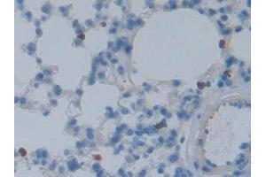 Immunohistochemistry (IHC) image for anti-DNA Fragmentation Factor, 45kDa, alpha Polypeptide (DFFA) (AA 19-262) antibody (ABIN5013466)