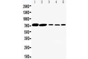Anti-SGLT1 antibody, Western blotting Lane 1: Rat Kidney Tissue Lysate Lane 2: Rat Heart Tissue Lysate Lane 3: HELA Cell Lysate Lane 4: SW620 Cell Lysate Lane 5: COLO320 Cell Lysate (SLC5A1 Antikörper  (C-Term))