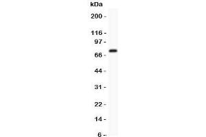 Western Blotting (WB) image for anti-Potassium Voltage-Gated Channel, Shal-Related Subfamily, Member 3 (KCND3) (AA 1-177) antibody (ABIN3032287)