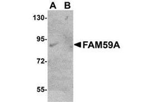 Western blot analysis of FAM59A in rat liver tissue lysate with AP30330PU-N FAM59A antibody at (A) 1 and (B) 2 μg/ml. (FAM59A Antikörper  (C-Term))