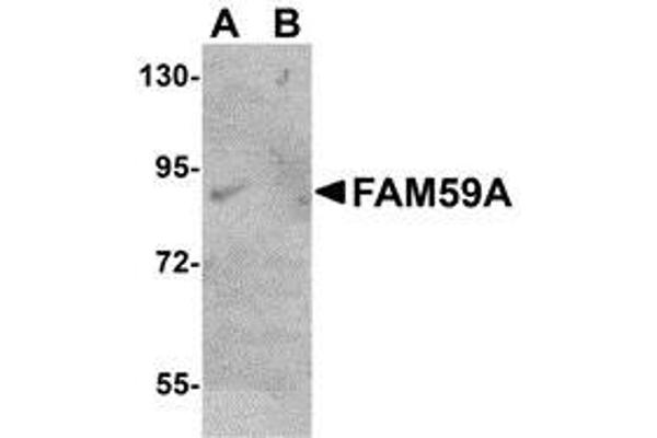 FAM59A Antikörper  (C-Term)