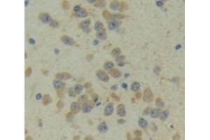 Used in DAB staining on fromalin fixed paraffin- embedded Kidney tissue (CITED1 Antikörper  (AA 1-203))