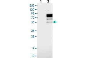 Western blot analysis of Lane 1: Negative control (vector only transfected HEK293T lysate), Lane 2: Over-expression Lysate (Co-expressed with a C-terminal myc-DDK tag (~3. (PRCC Antikörper)