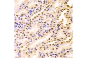 Immunohistochemistry of paraffin-embedded rat kidney using HDGF Antibody (ABIN1876535) at dilution of 1:100 (40x lens). (HDGF Antikörper)