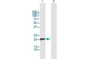 Western Blot analysis of RHOQ expression in transfected 293T cell line by RHOQ MaxPab polyclonal antibody. (RHOQ Antikörper  (AA 1-205))