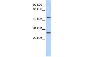 PRAMEF10 antibody used at 1 ug/ml to detect target protein. (PRAMEF10 Antikörper  (Middle Region))