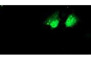 Anti-NHEJ1 mouse monoclonal antibody (ABIN2453926) immunofluorescent staining of COS7 cells transiently transfected by pCMV6-ENTRY NHEJ1 (RC203393). (NHEJ1 Antikörper)