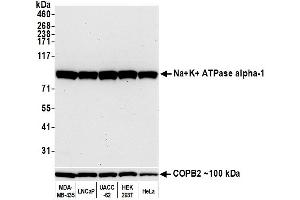 Western Blotting (WB) image for anti-alpha 1 Sodium Potassium Atpase antibody (ABIN7455086) (alpha 1 Sodium Potassium Atpase Antikörper)
