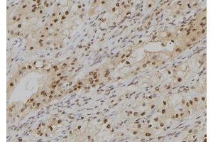 Immunohistochemistry (IHC) image for anti-Polymerase (DNA-Directed), delta 4, Accessory Subunit (POLD4) (Internal Region) antibody (ABIN6264334)