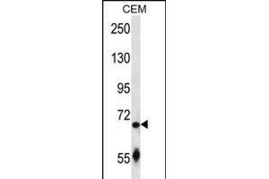 SLC27A3 Antibody (N-term) (ABIN657380 and ABIN2846425) western blot analysis in CEM cell line lysates (35 μg/lane). (SLC27A3 Antikörper  (N-Term))