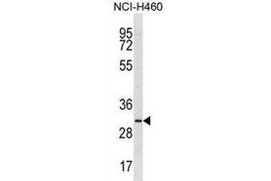TMIGD2 Antibody (Center) (ABIN1881890 and ABIN2839020) western blot analysis in NCI- cell line lysates (35 μg/lane). (TMIGD2 Antikörper  (AA 119-147))