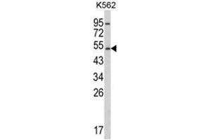 Western blot analysis of CYP2E1 Antibody (C-term) in K562 cell line lysates (35ug/lane). (CYP2E1 Antikörper  (C-Term))