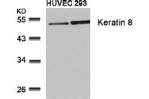 Image no. 3 for anti-Keratin 8 (KRT8) (Ser73) antibody (ABIN197582) (KRT8 Antikörper  (Ser73))