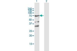 Western Blot analysis of ZYX expression in transfected 293T cell line by ZYX MaxPab polyclonal antibody. (ZYX Antikörper  (AA 1-572))