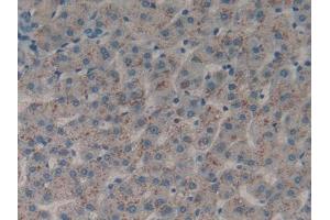 IHC-P analysis of Human Liver Tissue, with DAB staining. (DDR1 Antikörper  (AA 568-829))