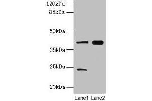 Western blot All lanes: MAP2K3 antibody at 10 μg/mL Lane 1: RAW264. (MAP2K3 Antikörper  (AA 1-347))