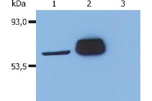 Western Blotting analysis (reducing conditions) of human Lck in whole cell lysate using anti-human Lck (LCK-01). (LCK Antikörper  (AA 22-36))