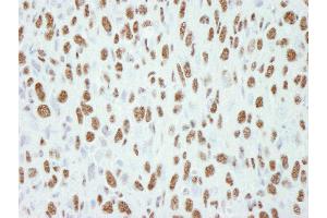 Immunohistochemistry (IHC) image for anti-Transcription Elongation Regulator 1 (TCERG1) (AA 1-50) antibody (ABIN7448453) (TCERG1 Antikörper  (AA 1-50))