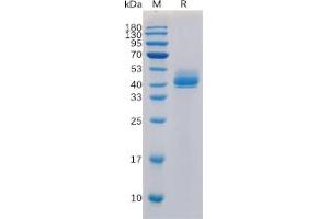Human TGFBR1 Protein, hFc Tag on SDS-PAGE under reducing condition. (TGFBR1 Protein (Fc Tag))