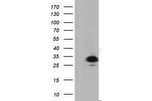 Western Blotting (WB) image for anti-Pyrroline-5-Carboxylate Reductase Family, Member 2 (PYCR2) antibody (ABIN1499983)