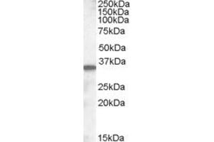 Western Blotting (WB) image for anti-Solute Carrier Family 10 (Sodium/bile Acid Cotransporter Family), Member 2 (SLC10A2) (AA 337-348) antibody (ABIN343101)